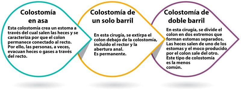 Tipos de colostomía transversal