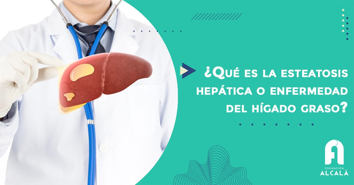 Imagen de ¿Qué es la esteatosis hepática o enfermedad del hígado graso?