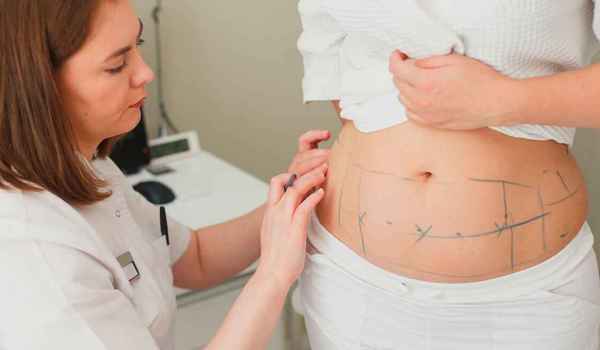 Curso de Cuidados e intervención profesional en la cirugía de la obesidad