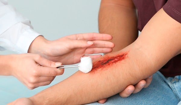 Máster de Formación Permanente en Curación y Manejo de Heridas