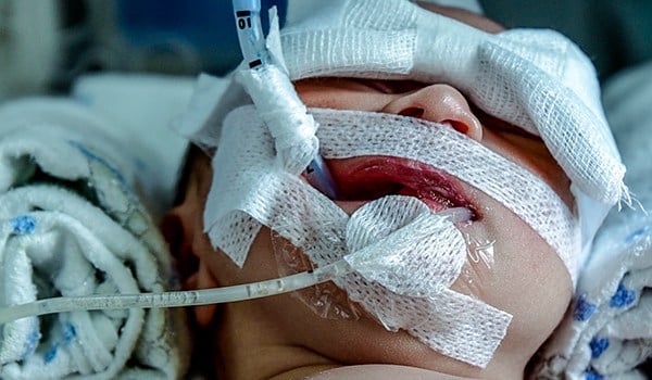 Máster de Formación Permanente en Neonatología y Pediatría Crítica Enfermera