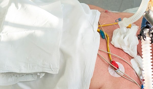 Curso Superior Universitario en Urgencias Respiratorias