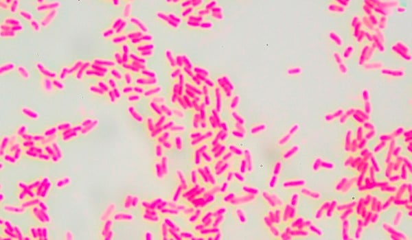 Actualización multidisciplinar en enfermedades infecciosas por grampositivas
