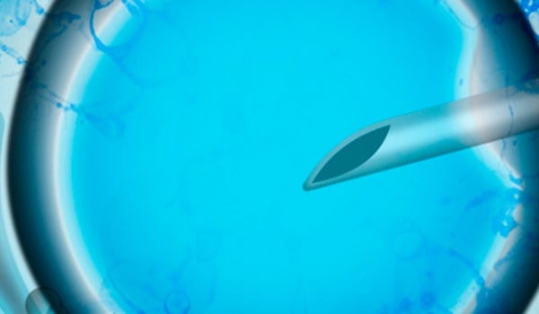 Técnicas de reproducción humana asistida