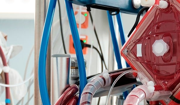 Experto Universitario de Posgrado en Enfermería Perfusionista Y Oxigenación Extracorpórea (ECMO)