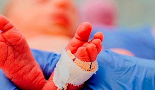 Cuidados intensivos en enfermería neonatal