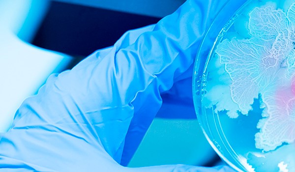 Técnicas de identificación de bacterias y hongos en microbiología clínica