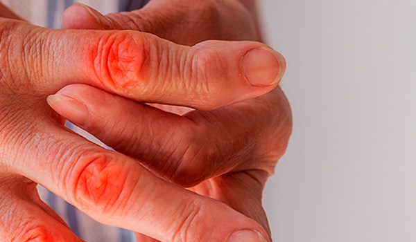 Abordaje terapéutico de la artrosis de mano desde la terapia ocupacional