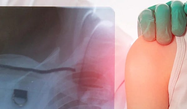 Curso Universitario en Urgencias Pediátricas: Manejo de Patologías Críticas y Emergencias Traumáticas