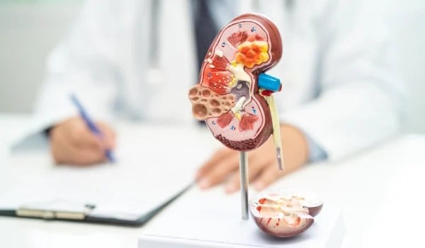 Máster de Formación Permanente en Nefrología Clínica, Trasplante Renal y Hemodiálisis