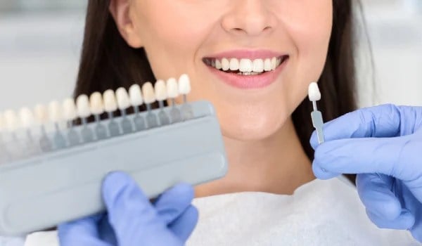 Curso Universitario en Blanqueamiento Dental Profesional. Técnicas Clínicas, Combinadas y Domiciliarias