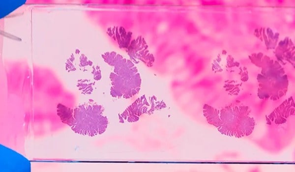 Diagnóstico por imagen en patología mamaria