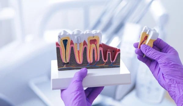 Curso Universitario en Endodoncia Clínica Integral: Tratamiento Convencional, Cirugía y Tecnologías Avanzadas