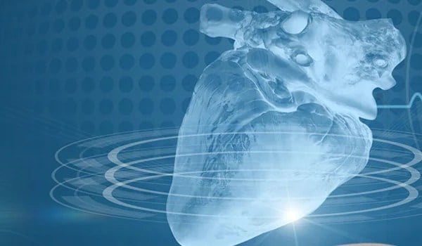 Técnicas para el diagnóstico cardiológico por imagen