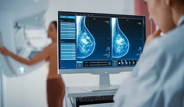 Experto Universitario de Posgrado en Actualización en Patología Mamaria y Cáncer de Mama