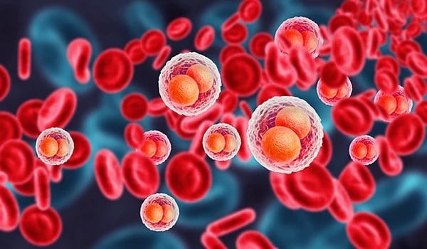 Curso Universitario en Hemoterapia