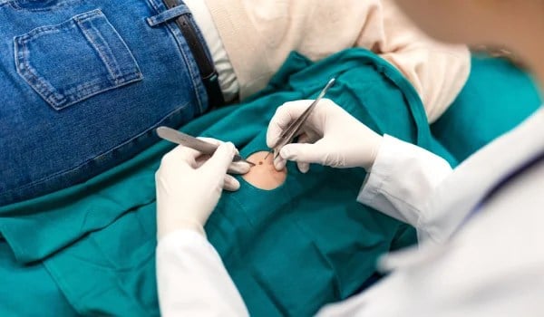 Procesamiento Técnico de Piezas Quirúrgicas y Gestión del Circuito en Anatomía Patológica