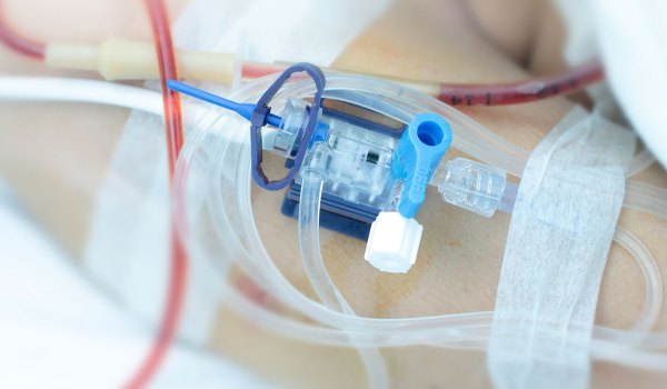 Curso Superior Universitario en acceso arterial periférico ecoguiado en reanimación y cuidados intensivos