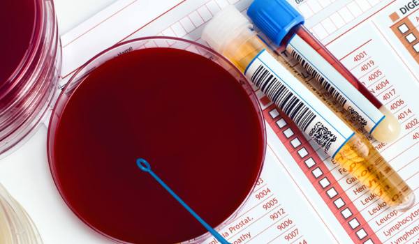 Máster de Formación Permanente en Laboratorio de Análisis Clínicos