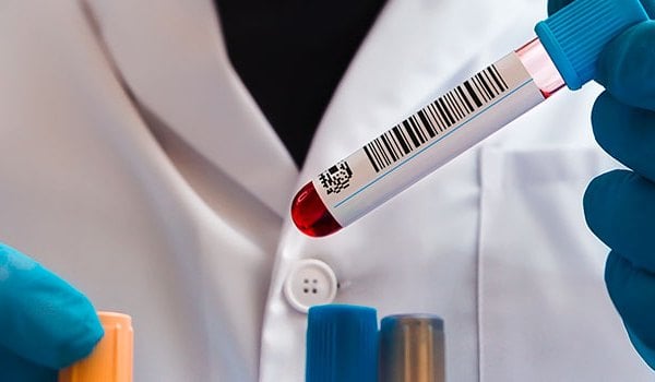 Especialista Universitario en Hematología y Oncología Clínica