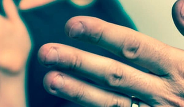 Curso Universitario en Prevención de la Violencia de Género