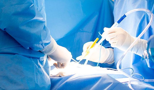 Experto Universitario Internacional en Enfermería en Quirófano y Cuidados Perioperatorios