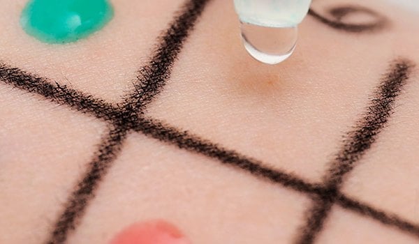 Experto Universitario en Alergología