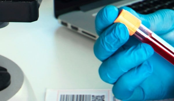 Experto Universitario en Laboratorio Clínico para Técnico Superior de Laboratorio Clínico y Biomédico