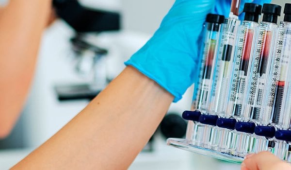 Especialista Universitario en Patologías Hematológicas