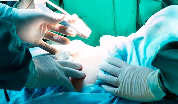 Experto Universitario en Cirugía Mayor Ambulatoria