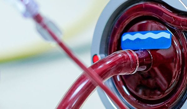 Experto Universitario en Terapia Intravenosa y Accesos Arteriales