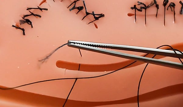 Curso Superior Universitario en Fundamentos Aplicados a las Suturas y Apósitos