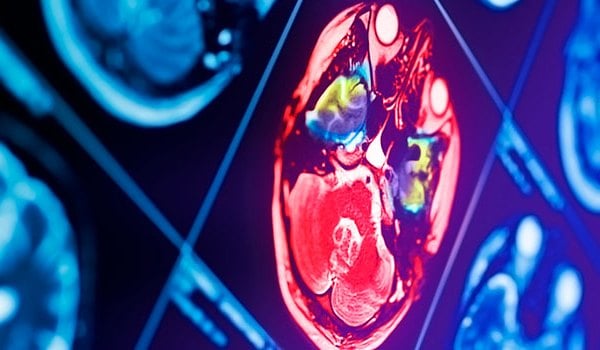 Especialista Universitario en Oncología