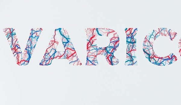 Experto Universitario Internacional de Enfermería en Alteraciones Vasculares y Arteriales