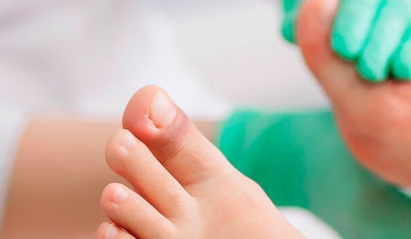 Curso Universitario en Efectividad de la Terapia Manual en el Tratamiento de la Fascitis Plantar