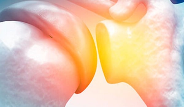 Curso de Complejo Articular del Hombro