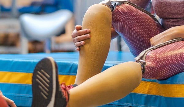 Curso de Fisioterapia en Amputados