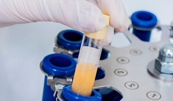 Curso Universitario en Tratamiento con Plasma Rico en Plaquetas