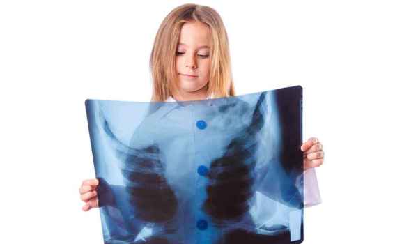 Curso de Radiología pediátrica. Indicaciones, técnicas y optimización