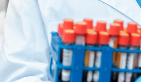 Experto Universitario en Bases del Diagnóstico Hematológico