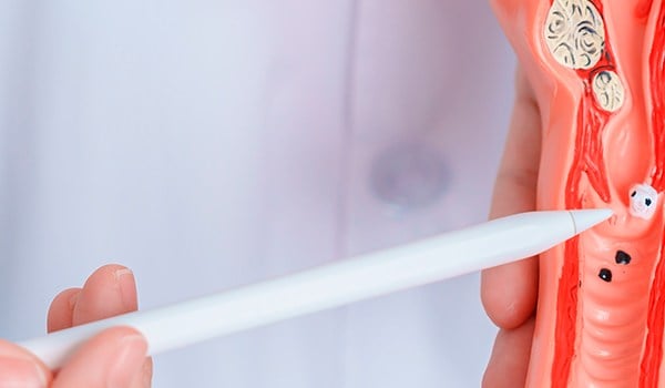 Curso Superior Universitario en Cuidados de Enfermería en los Trastornos Ginecológicos