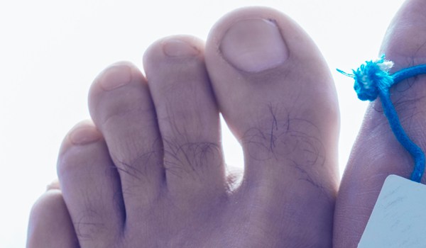 Curso Superior Universitario en Necropsias y Macroscopía