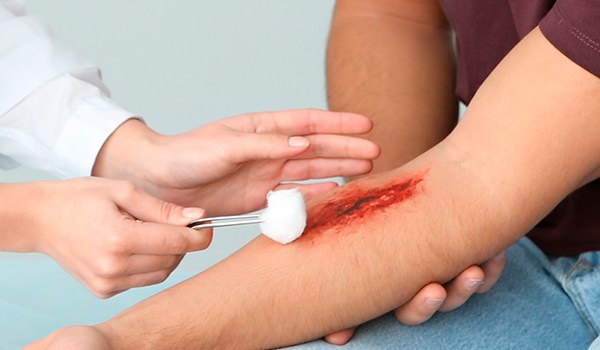 Máster de Formación Permanente en Curación y Manejo de Heridas