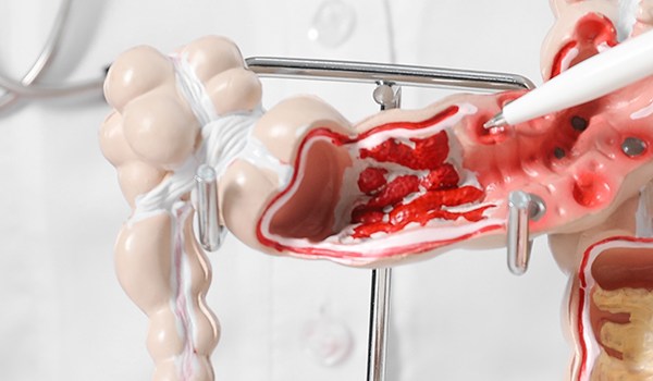 Máster de Formación Permanente en Actualización y Cuidados de Patologías Digestivas