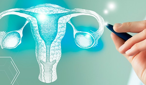 Curso Universitario en Oncología Ginecológica