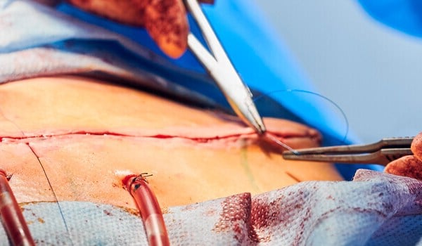 Curso Universitario en Suturas, Materiales y otras Técnicas