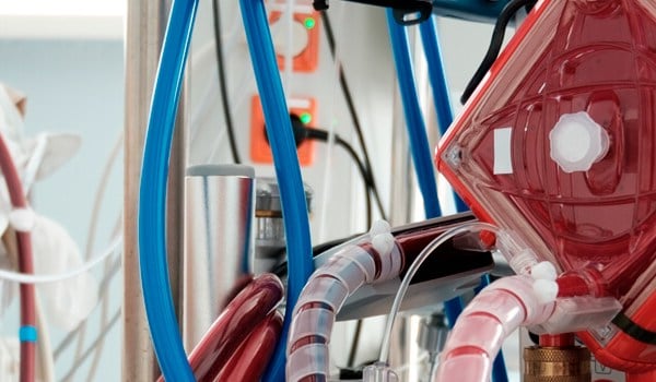 Curso Universitario en Oxigenación por Membrana Extracorpórea (ECMO). Cuidados de Enfermería