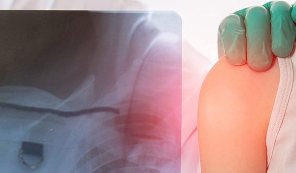 Curso Universitario en Urgencias Pediátricas: Manejo de Patologías Críticas y Emergencias Traumáticas