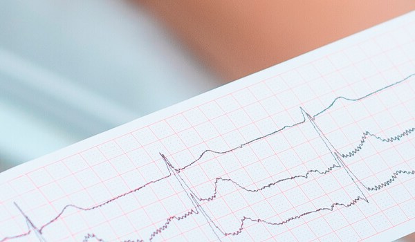 Curso de Actualización en Electrocardiografía para el Diagnóstico y Tratamiento de las Arritmias