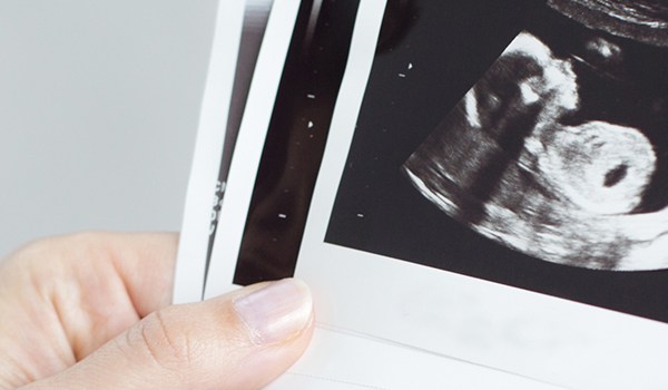 Curso de Ecografía para Matronas